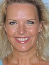 Photo of AnnaU
